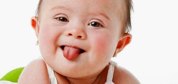 Doğuştan gelen ve genellikle yaşamın ilk üç yılında fark edilen