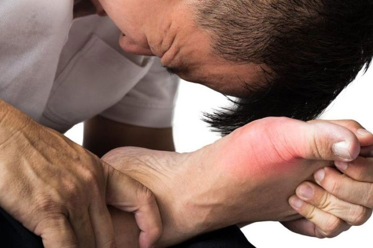 Çoğunlukla eklemde aniden gelişen ağrı, şişlik, kızarıklık ve hassasiyetle karakterize