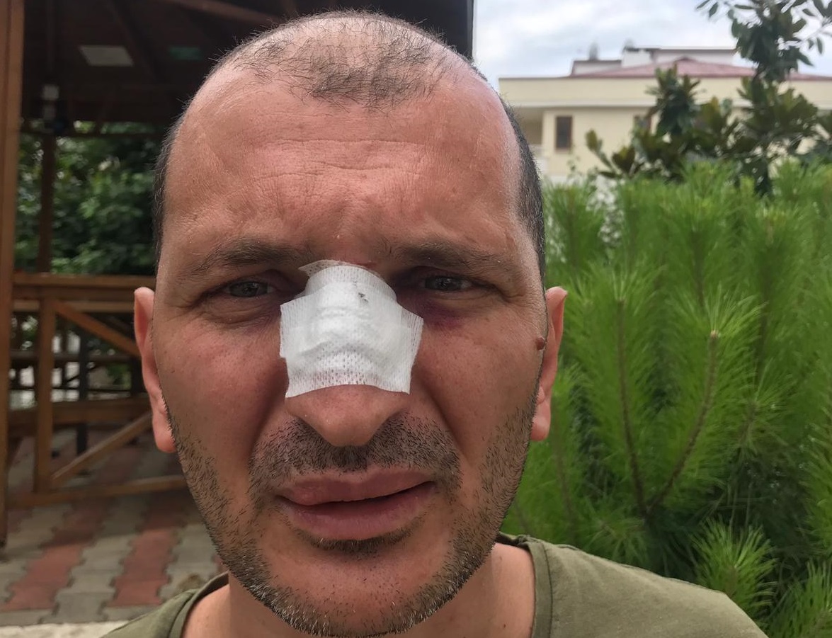 Son şiddet olayı Trabzon’daki Ahi Evren Göğüs Kalp ve Damar