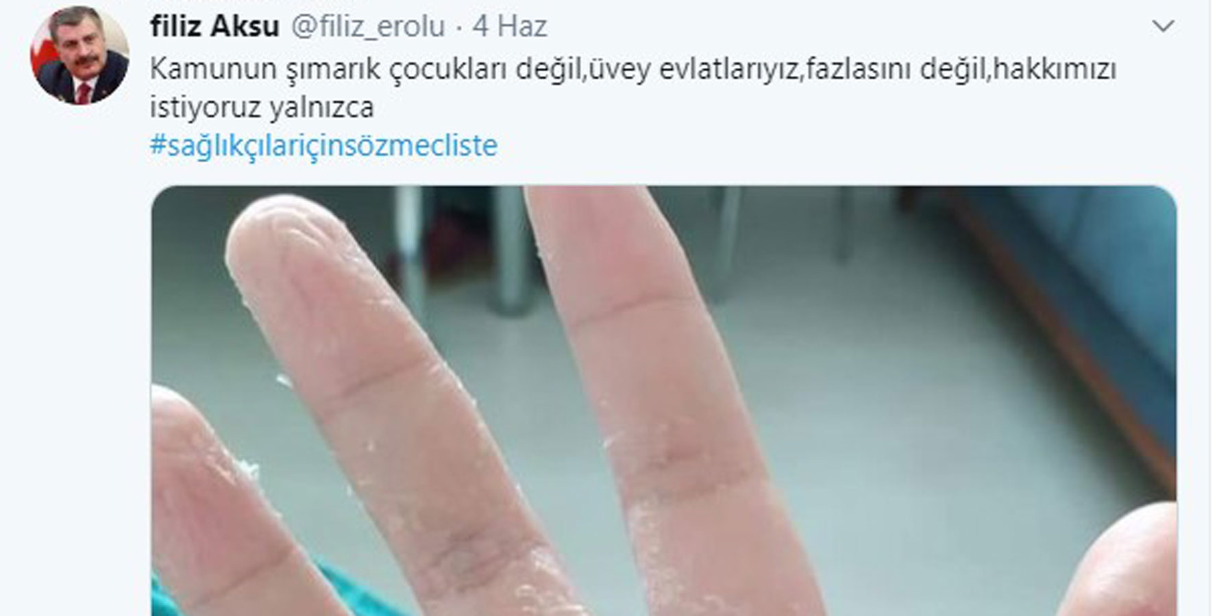 Sağlık çalışanlarından, ‘Sağlıkbakanıolsam’ kampanyası Sağlık çalışanları, sosyal medyada ‘Sağlıkbakanıolsam’ hastagiyle bir kampanya başlattı. Sağlık