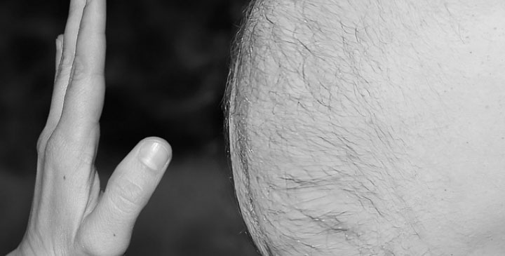 Dünya Obezite Federasyonu’na göre, yetişkinlerin çoğunun fazla kilolu olduğu ülkelerde