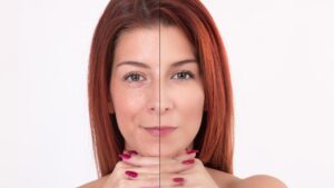 Kollajen Takviyeleri Neden Tercih Ediliyor?