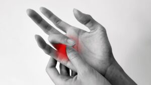 Beyin Hastanesi Ortopedi Uzmanı Yrd. Doç. Dr. Numan Duman, tetik