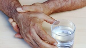 Parkinson hastalığının, sinsi ve tek taraflı başladığını belirten uzmanlar, bu
