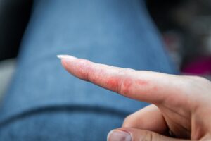 Türkiye Ulusal Alerji ve Klinik İmmünoloji Derneği Üyesi Prof. Dr.
