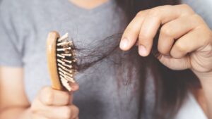 Günde 50-150 adet saç teli kaybının normal olduğunu ancak dökülmenin